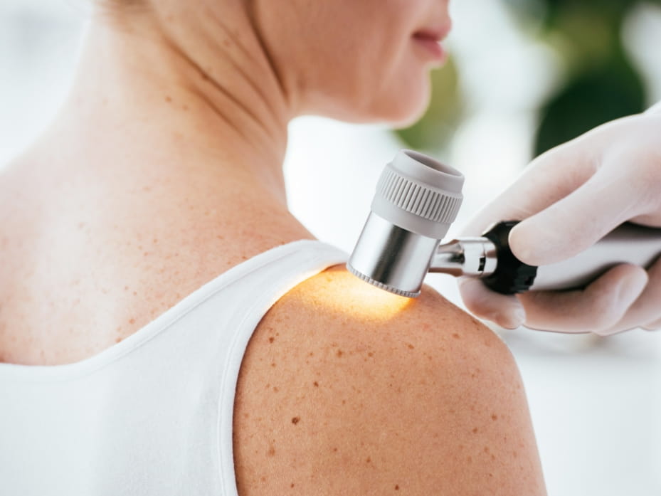 Check Up Dermatologia — Fenice Polispecialistica
